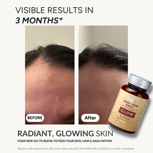 3-MONTH GROW & GLOW